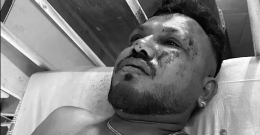 अहमदाबाद प्लेन क्रैश में चमत्कारी ढंग से बचा एक यात्री, बताया- आंखें खुली तो चारों ओर बिखरी थीं लाशें…